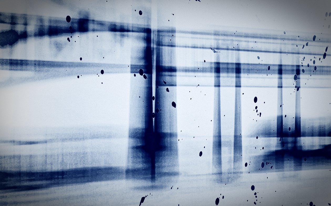 Kar (X-ray),2019,(fotoğraf) by Alex Caminker