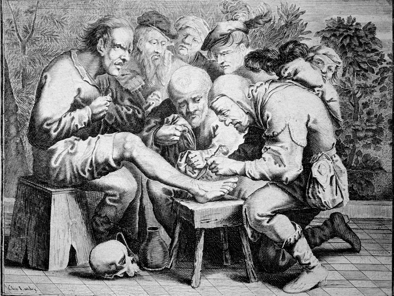 Ayak bileği ameliyatı (gravür by Anonymous Anonymous