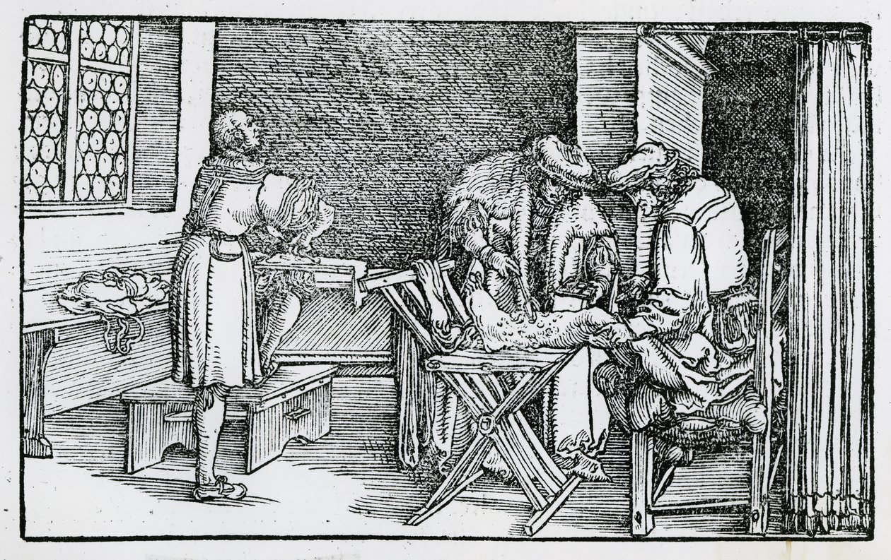 The Treatment of a Gangrenous Leg   by German School