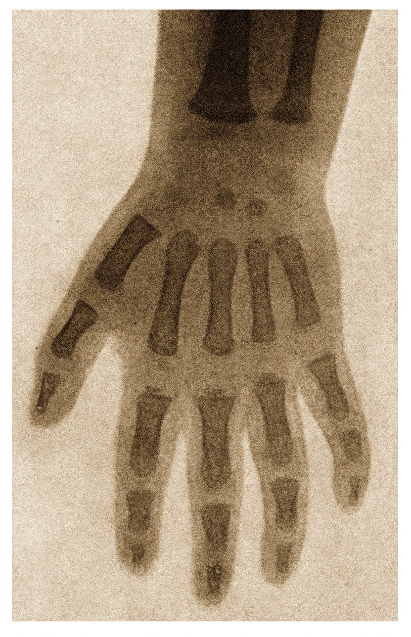 Bir çocuğun elinin röntgeni c.1890 by German School