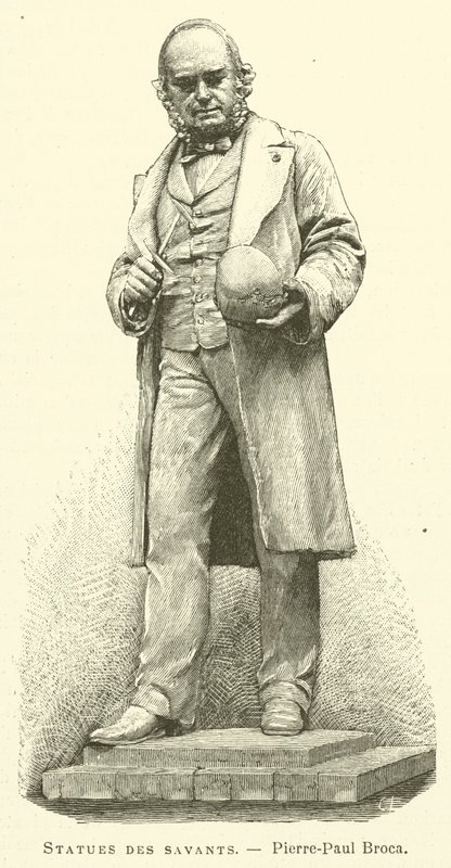 Bilim adamlarının heykelleri, Pierre-Paul Broca (gravür) by French School