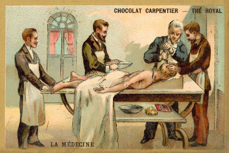 Trepanning (kromolito) by French School